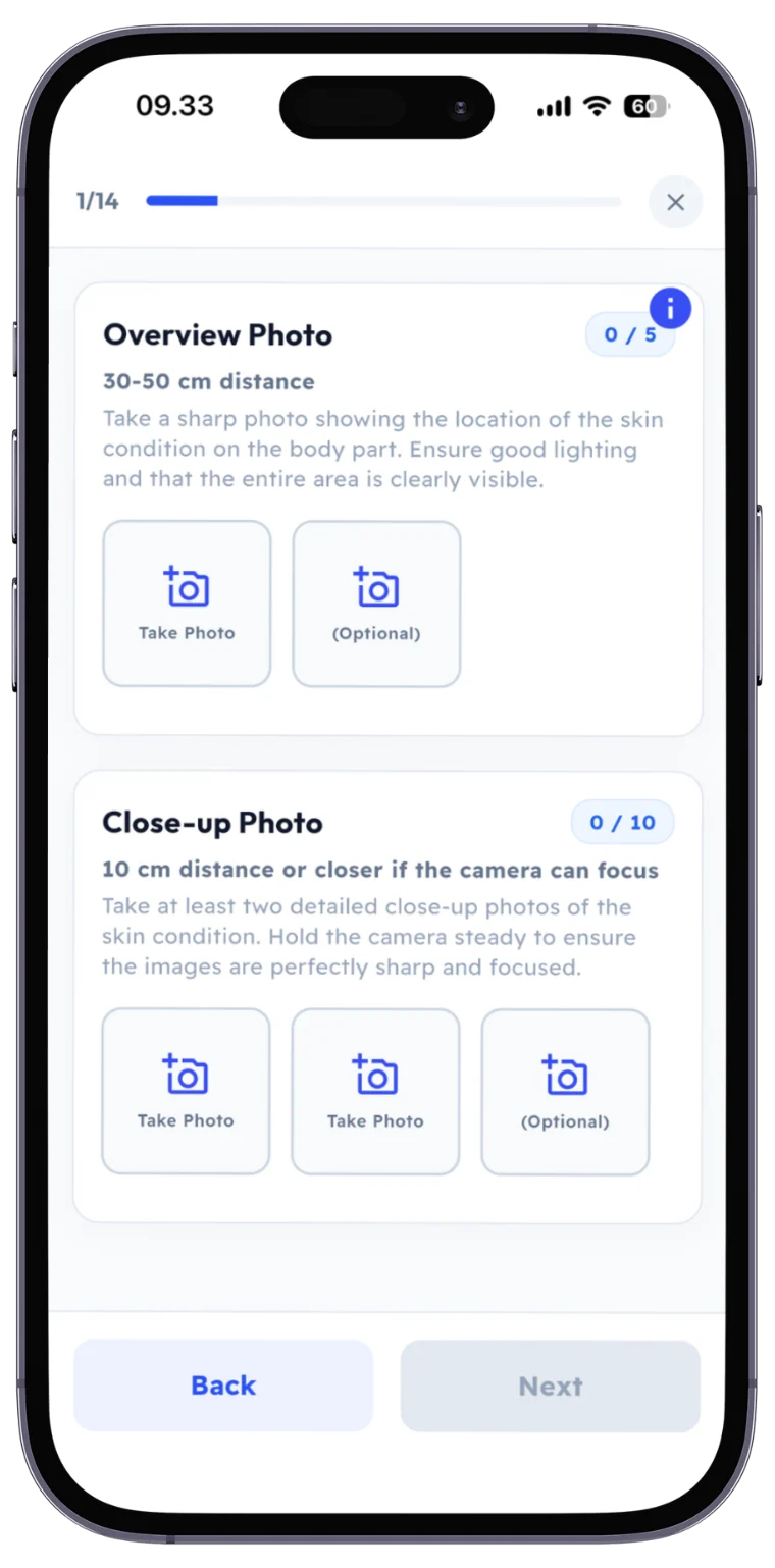 The SKIND app screen for the overview photo and close-ups