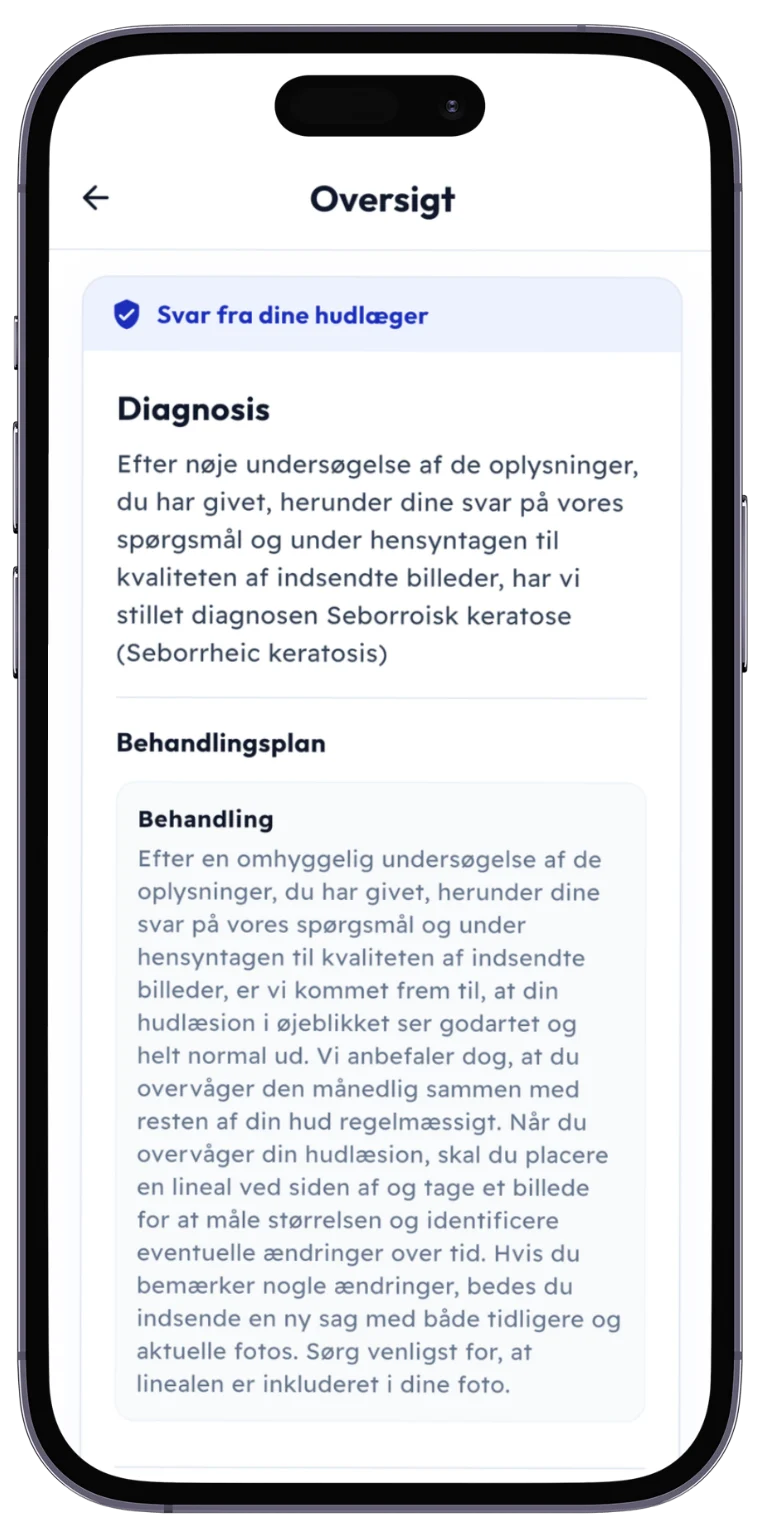 SKIND-appen viser hudlægens svar med diagnose og behandlingsplan
