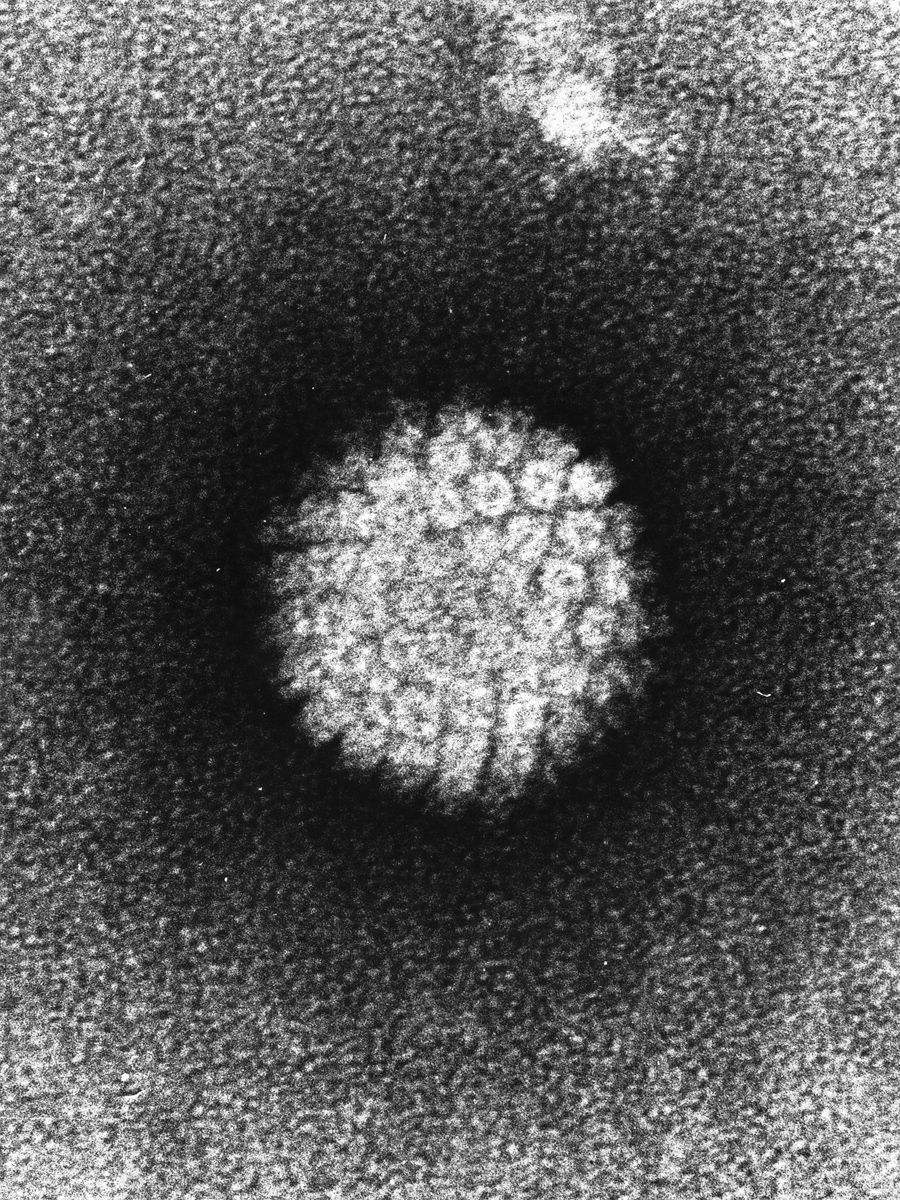 Humant papillomavirus (HPV) – elektronmikroskopi